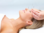 Acupuncture